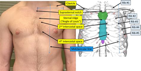 how to palpate intercostal spaces.